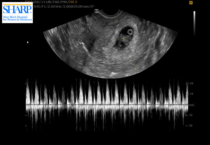 Baby #3! | PepperDesignBlog.com