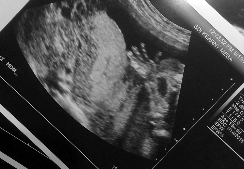 Baby #3 Ultrasound | PepperDesignBlog.com