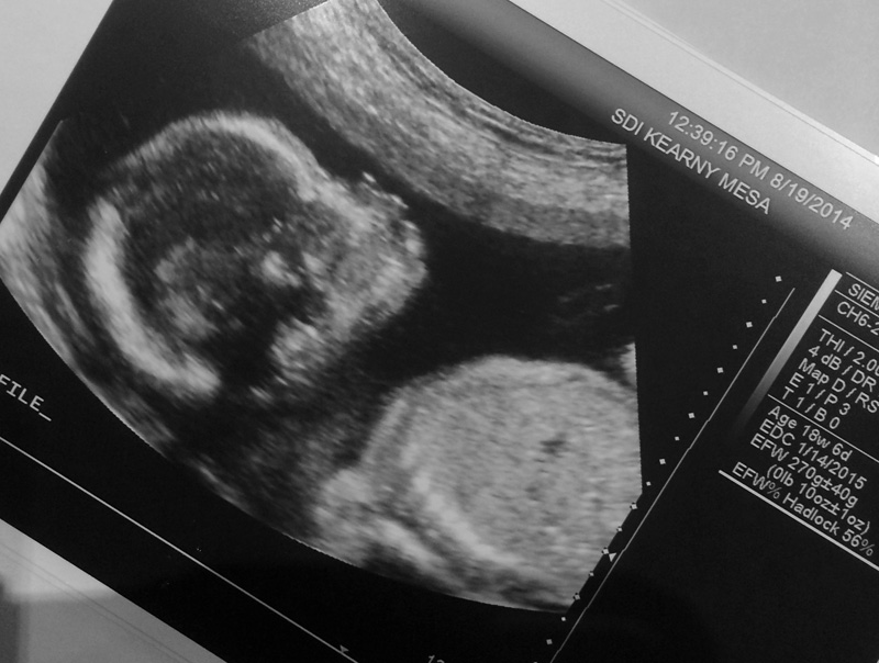 Baby #3 Ultrasound | PepperDesignBlog.com